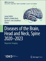 2020_Book_DiseasesOfTheBrainHeadAndNeckS.pdf.jpg